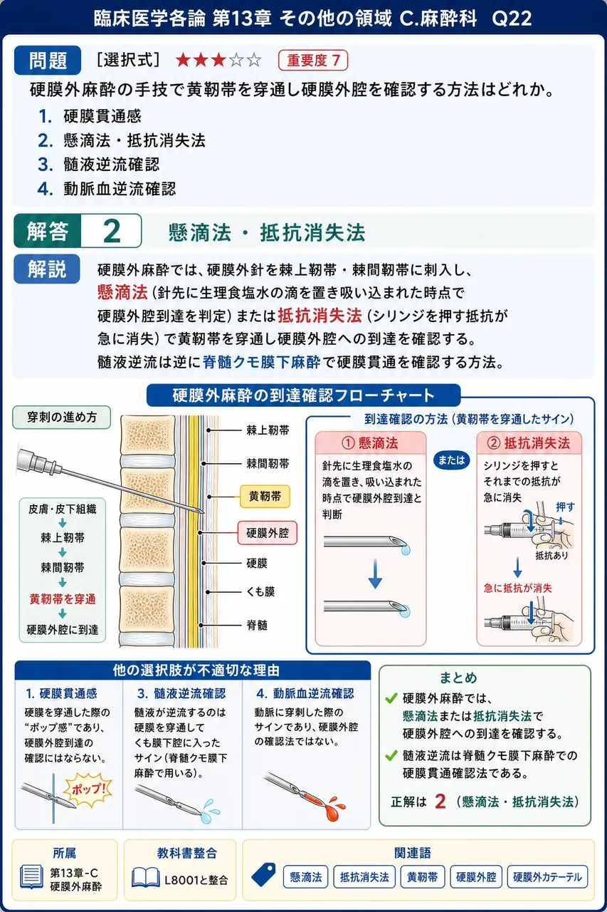 硬膜外麻酔の手技で黄靭帯を穿通し硬膜外腔を確認する方法はどれか。 解説図