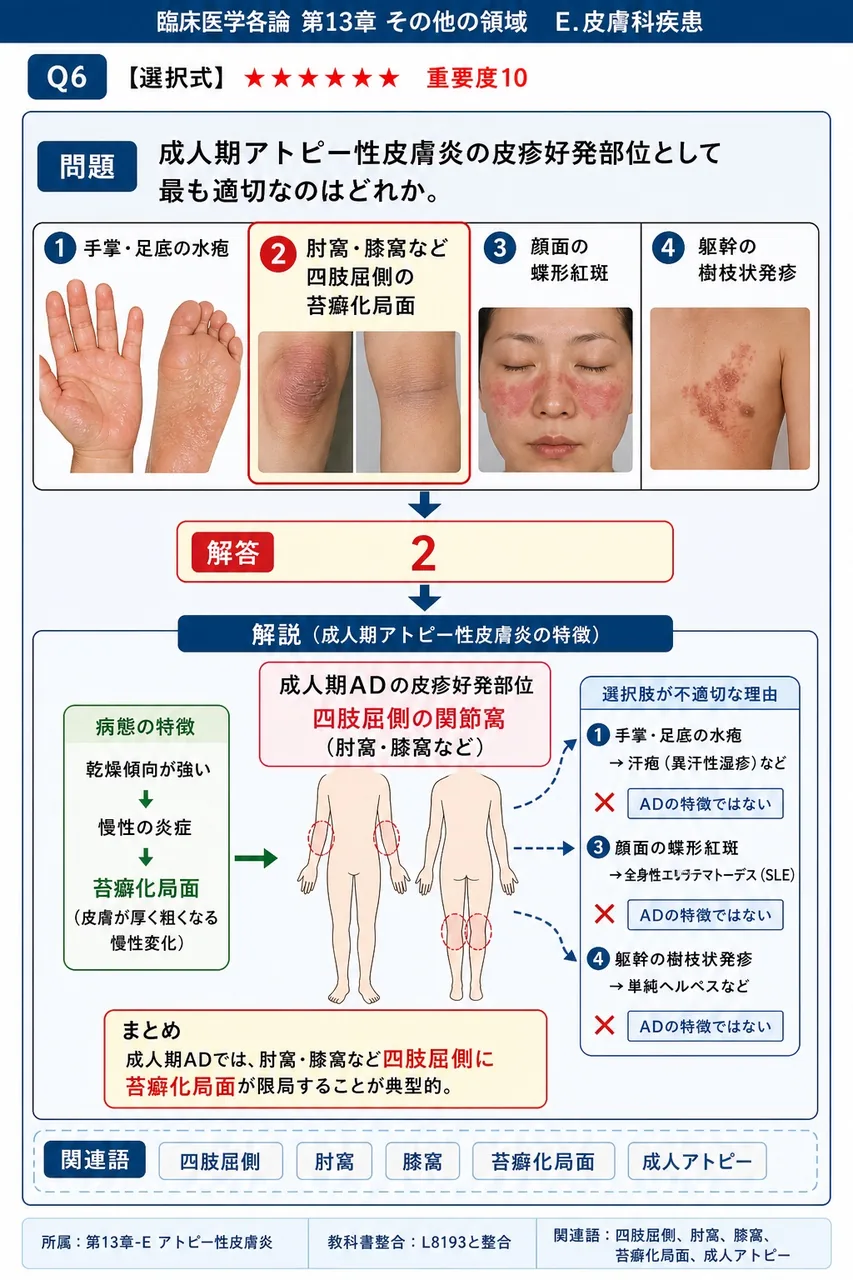 成人期アトピー性皮膚炎の皮疹好発部位として最も適切なのはどれか。 解説図