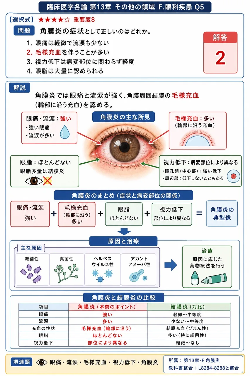 角膜炎の症状として正しいのはどれか。 解説図