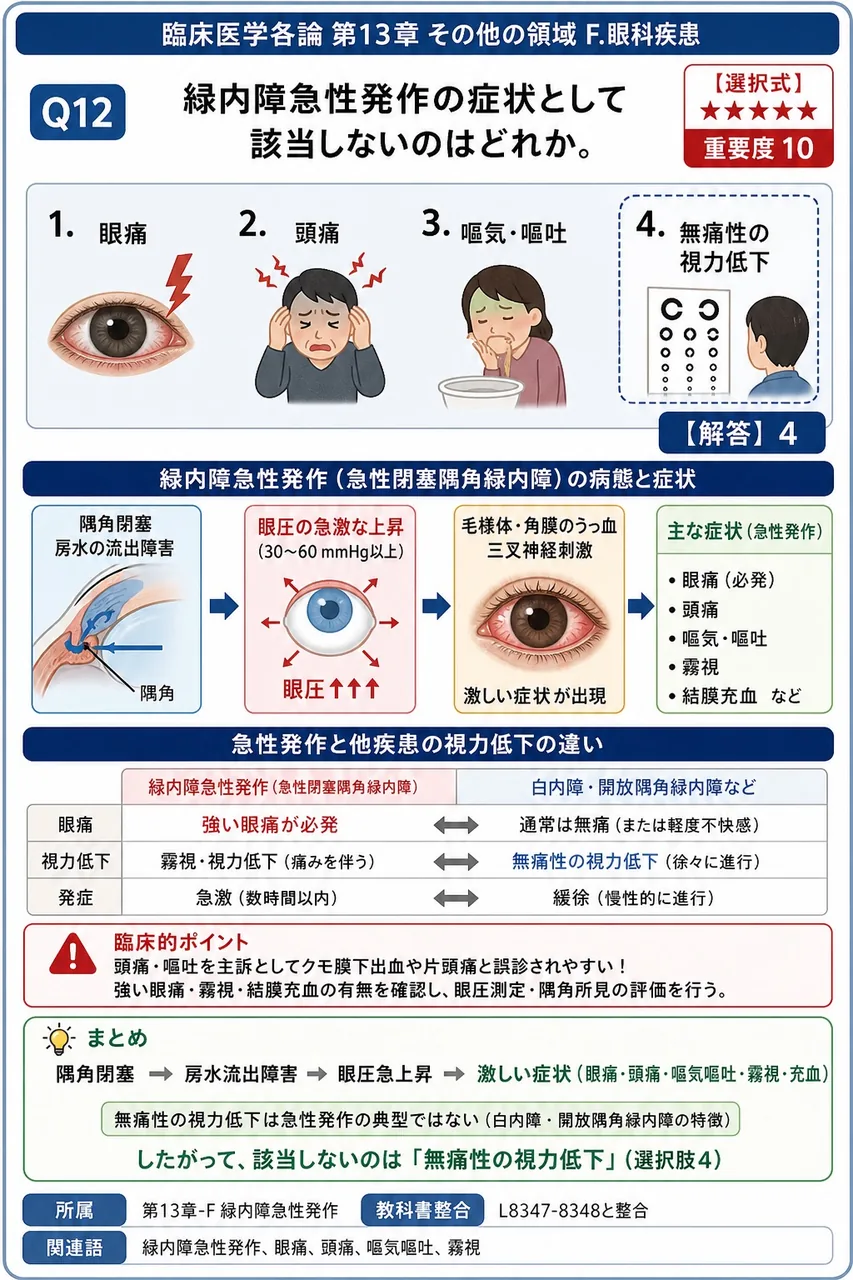 緑内障急性発作の症状として該当しないのはどれか。 解説図