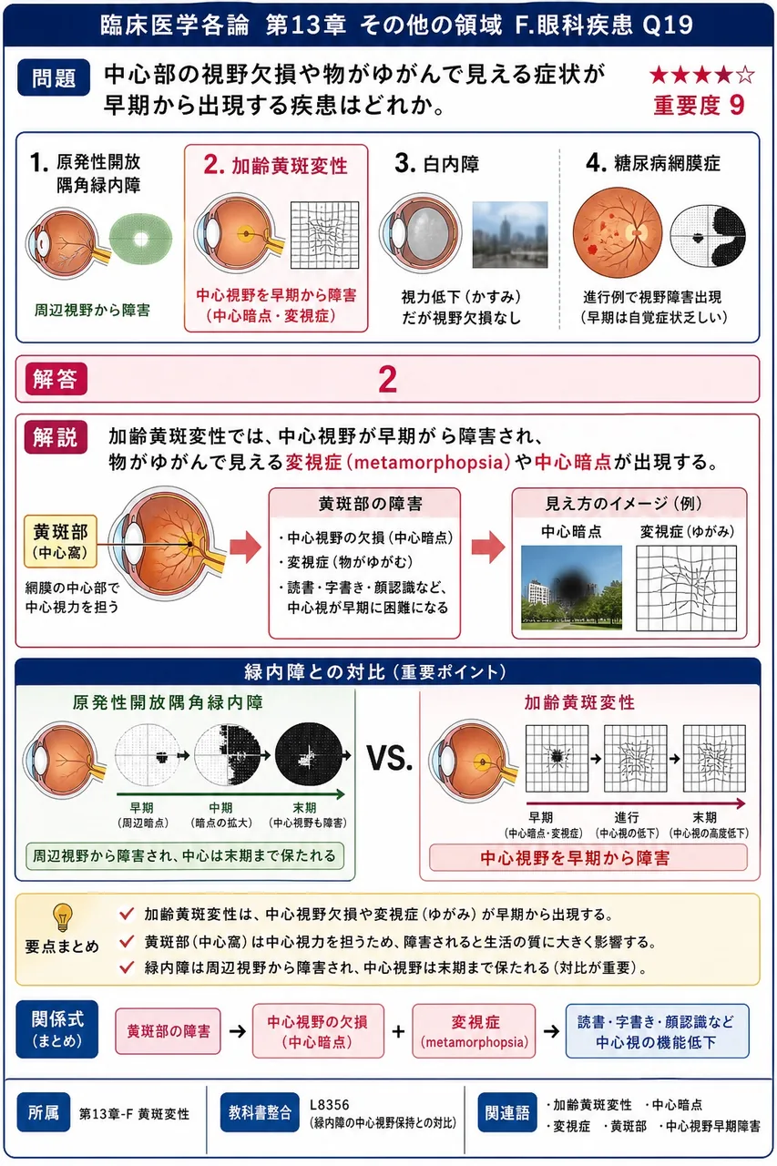 中心部の視野欠損や物がゆがんで見える症状が早期から出現する疾患はどれか。 解説図