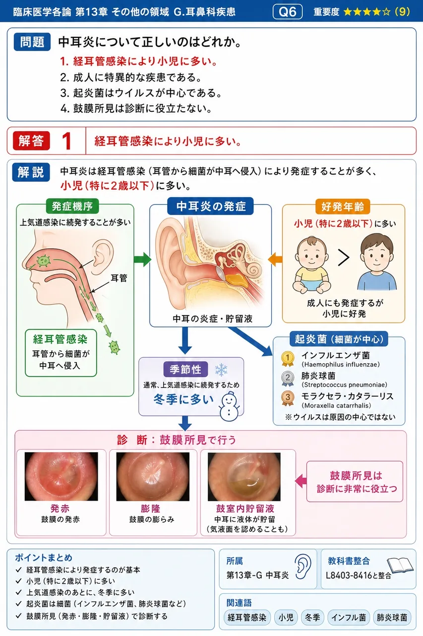 中耳炎について正しいのはどれか。 解説図