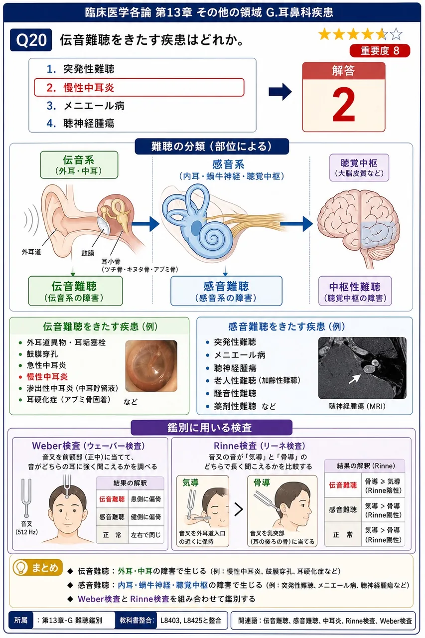 伝音難聴をきたす疾患はどれか。 解説図