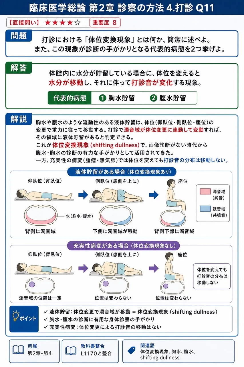 打診における「体位変換現象」とは何か、簡潔に述べよ。また、この現象が診断の手がかりとなる代表的病態を2つ挙げよ。 解説図