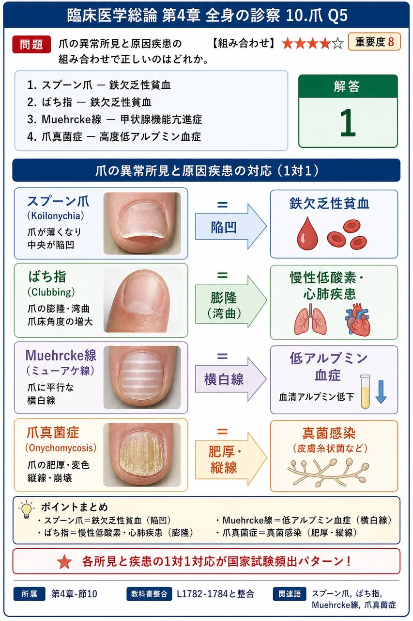 爪の異常所見と原因疾患の組み合わせで正しいのはどれか。 解説図