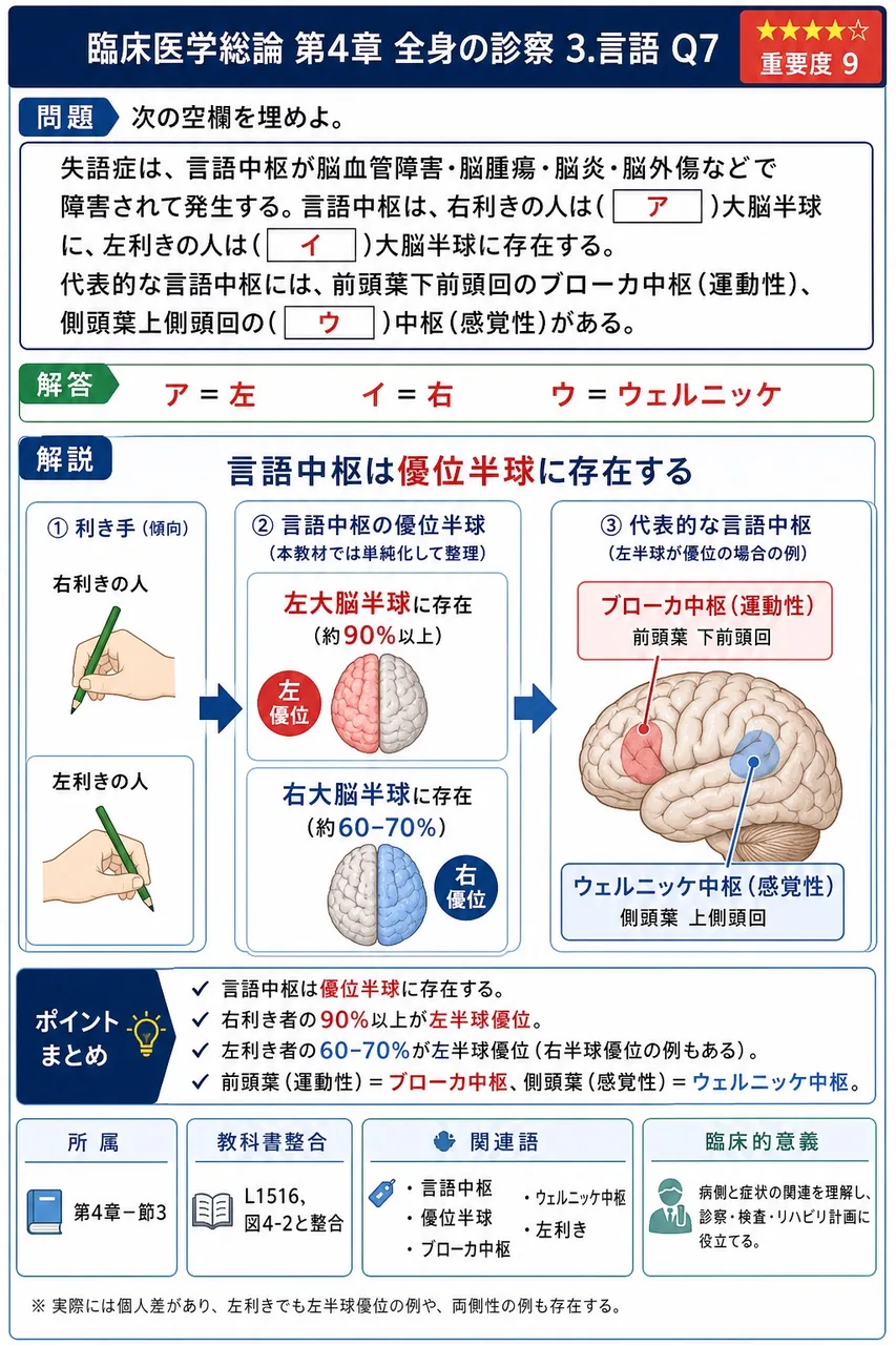 次の空欄を埋めよ。 「失語症は、言語中枢が脳血管障害・脳腫瘍・脳炎・脳外傷などで障害されて発生する。言語中枢は、**右利きの人は( ア )大脳半球**に、**左利きの人は( イ )大脳半球**に存在する。代表的な言語中枢には、前頭葉下前頭回のブローカ中枢(運動性)、側頭葉上側頭回の( ウ )中枢(感覚性)がある。」 解説図