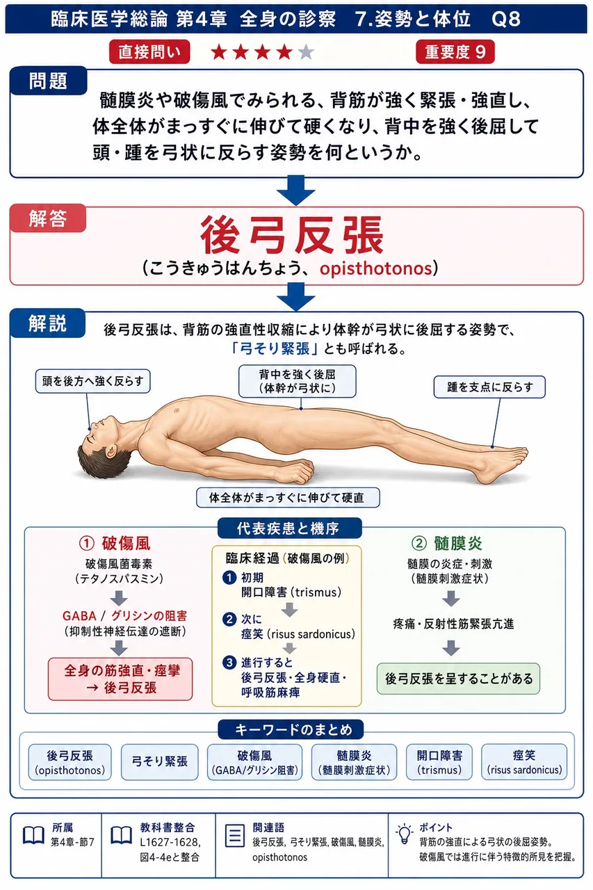 髄膜炎や破傷風でみられる、背筋が強く緊張・強直し、体全体がまっすぐに伸びて硬くなり、背中を強く後屈して頭・踵を弓状に反らす姿勢を何というか。 解説図