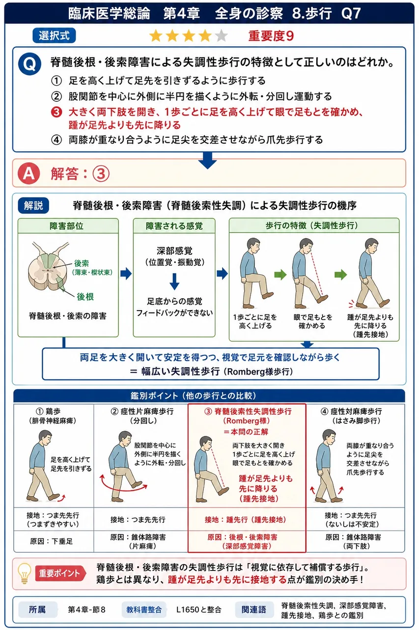 脊髄後根・後索障害による失調性歩行の特徴として正しいのはどれか。 解説図