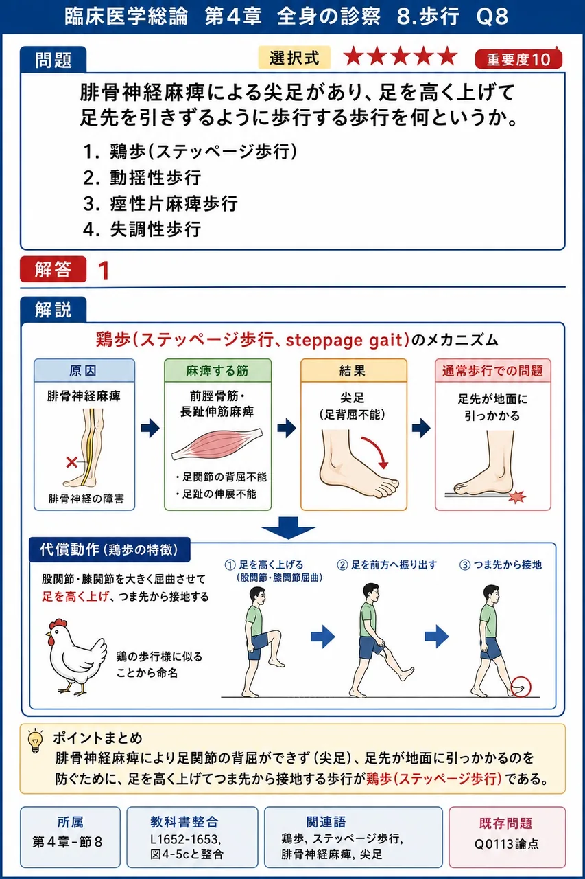 腓骨神経麻痺による尖足があり、足を高く上げて足先を引きずるように歩行する歩行を何というか。 解説図