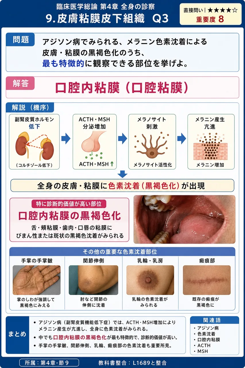 アジソン病でみられる、メラニン色素沈着による皮膚・粘膜の黒褐色化のうち、最も特徴的に観察できる部位を挙げよ。 解説図