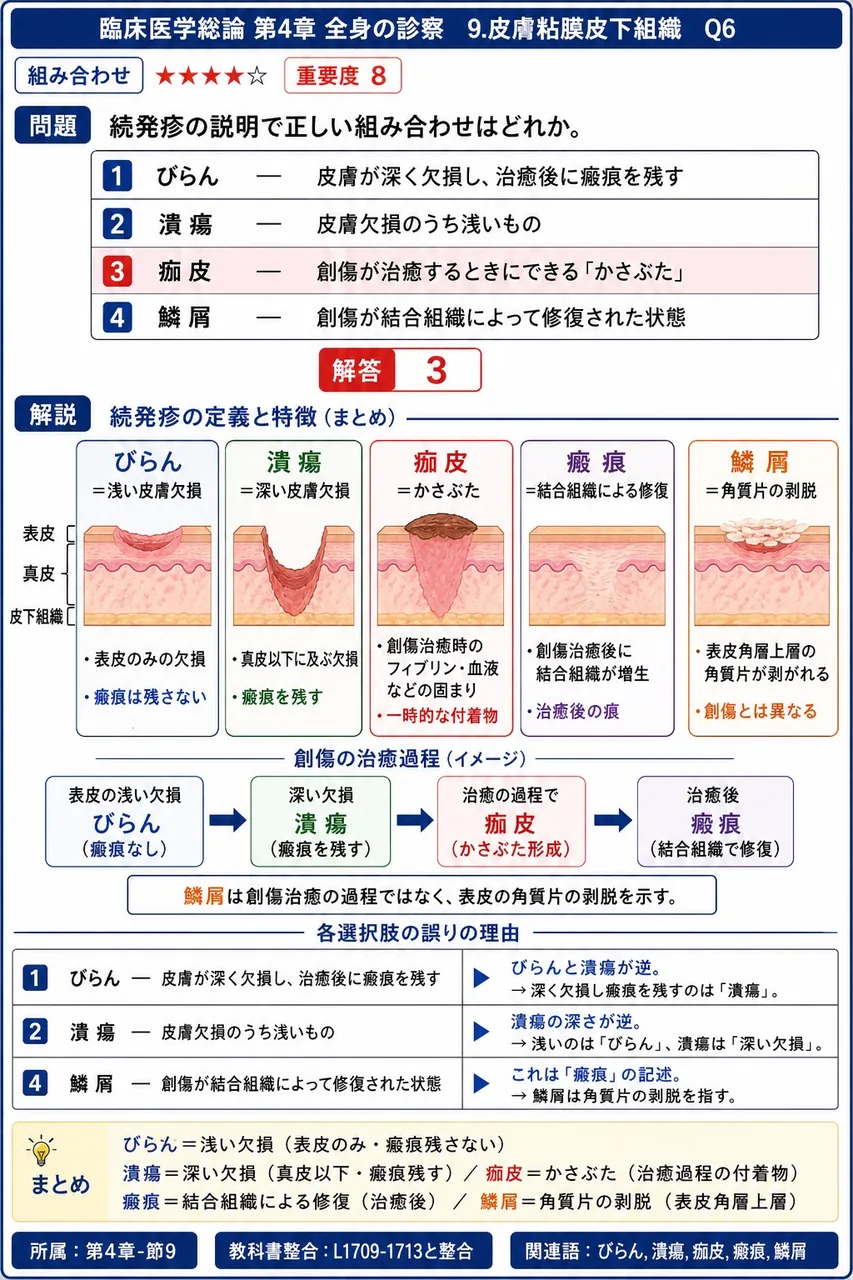 続発疹の説明で正しい組み合わせはどれか。 解説図