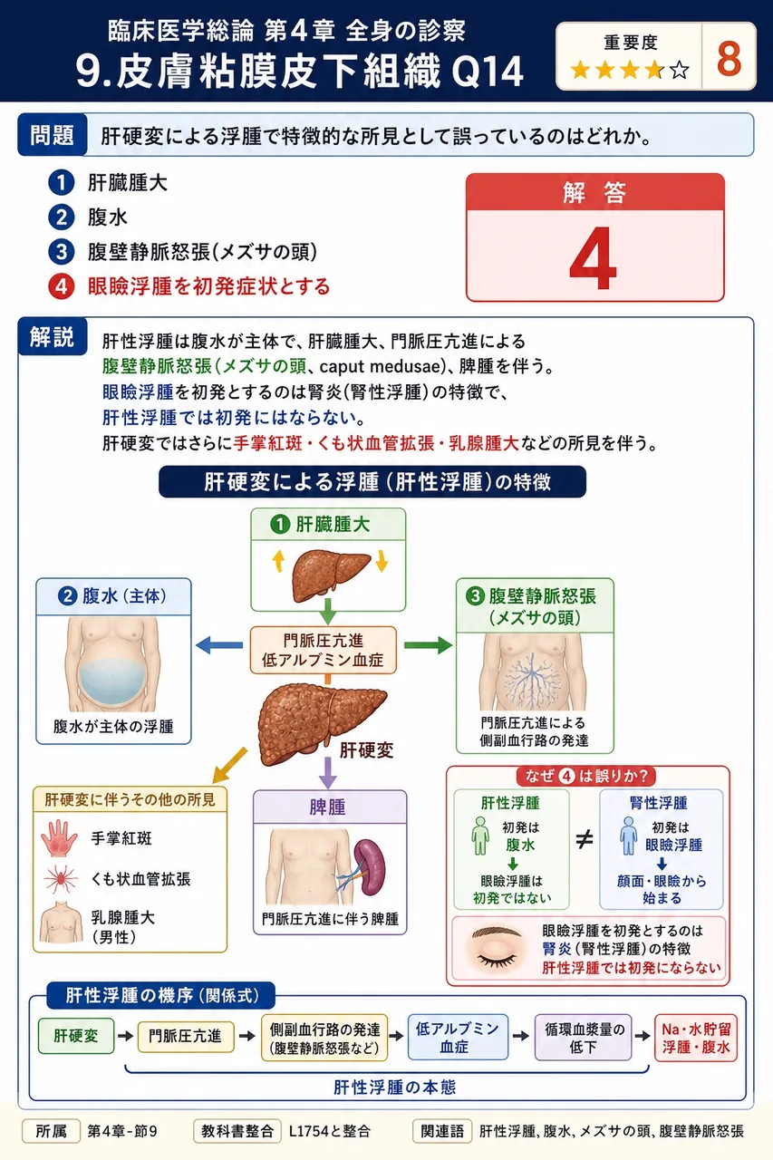 肝硬変による浮腫で特徴的な所見として誤っているのはどれか。 解説図