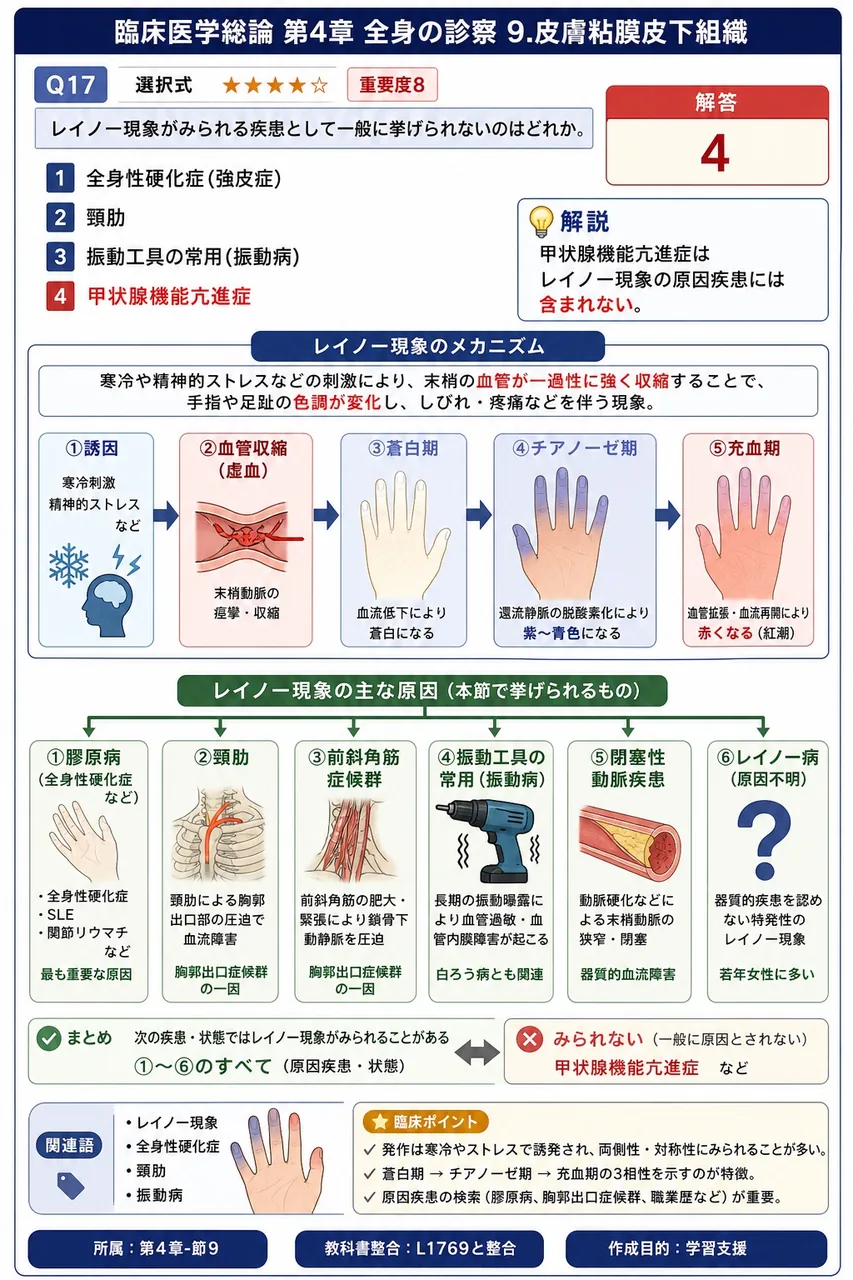 レイノー現象がみられる疾患として一般に挙げられないのはどれか。 解説図