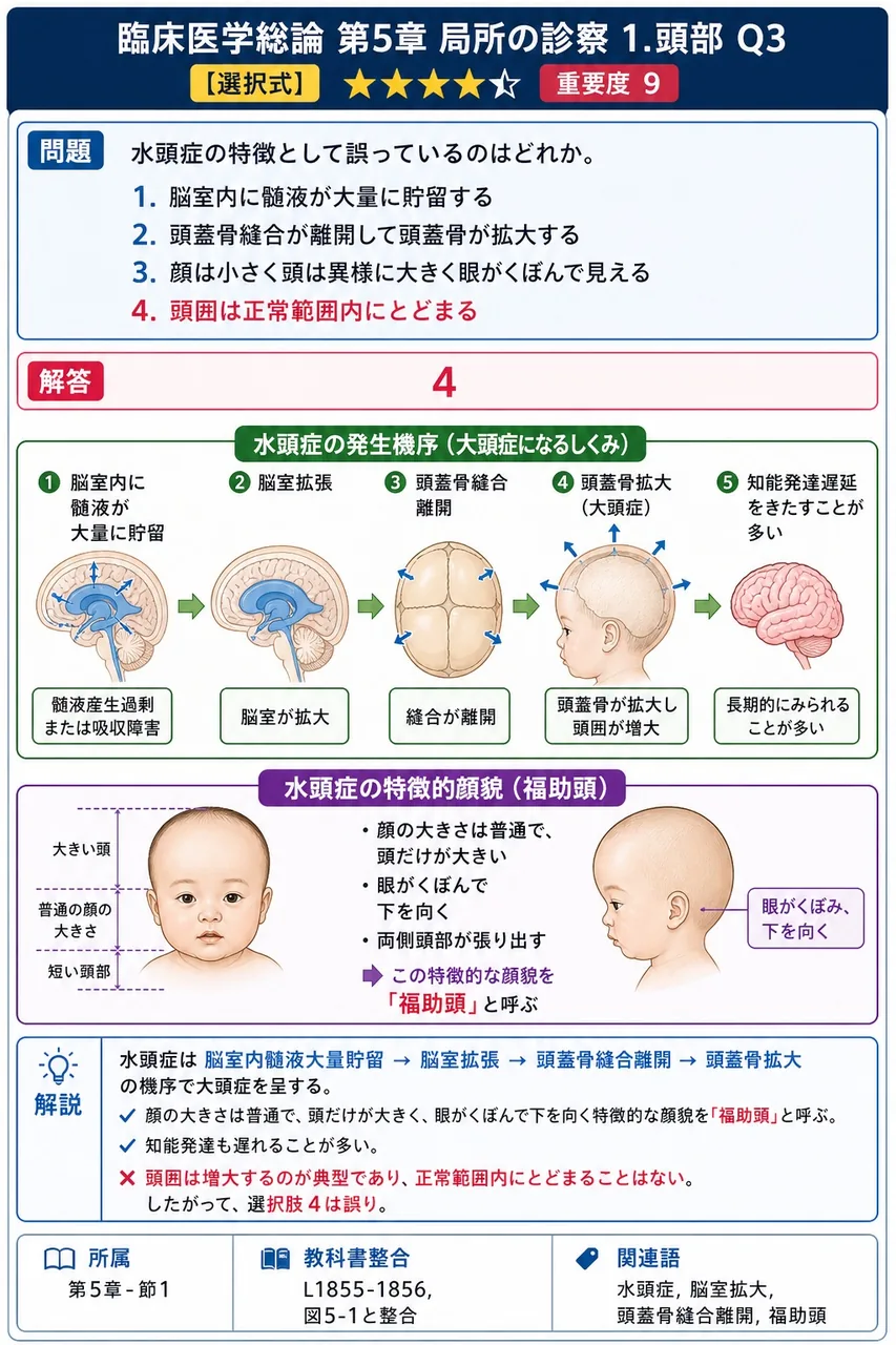 水頭症の特徴として誤っているのはどれか。 解説図