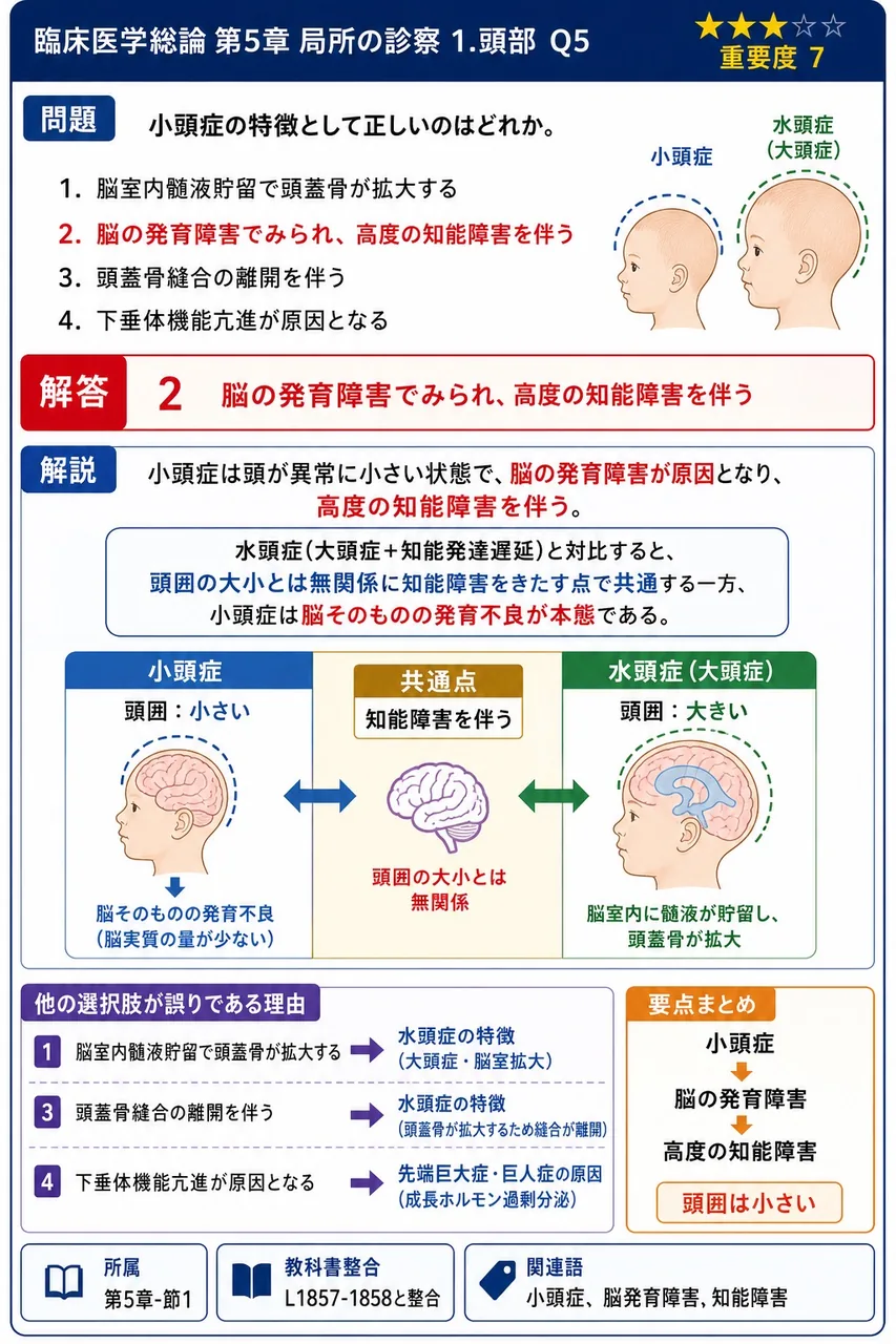 小頭症の特徴として正しいのはどれか。 解説図