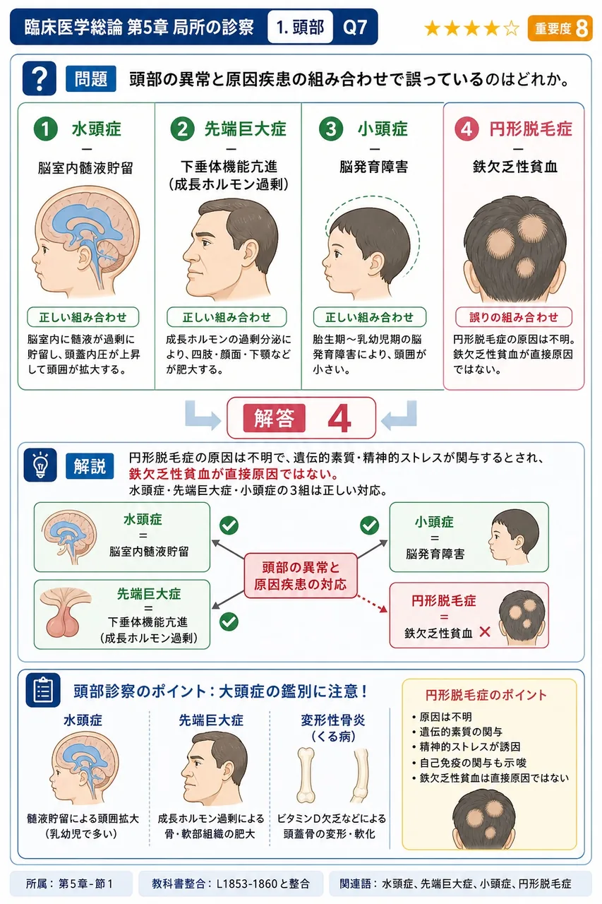 頭部の異常と原因疾患の組み合わせで誤っているのはどれか。 解説図