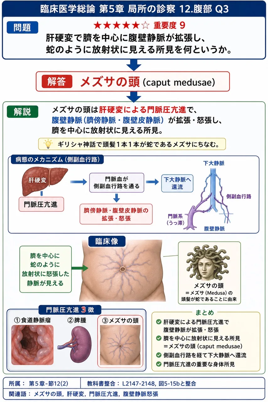 肝硬変で臍を中心に腹壁静脈が拡張し、蛇のように放射状に見える所見を何というか。 解説図