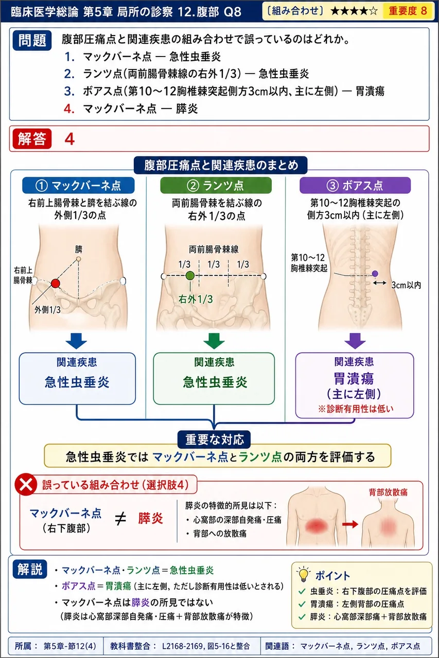 腹部圧痛点と関連疾患の組み合わせで誤っているのはどれか。 解説図
