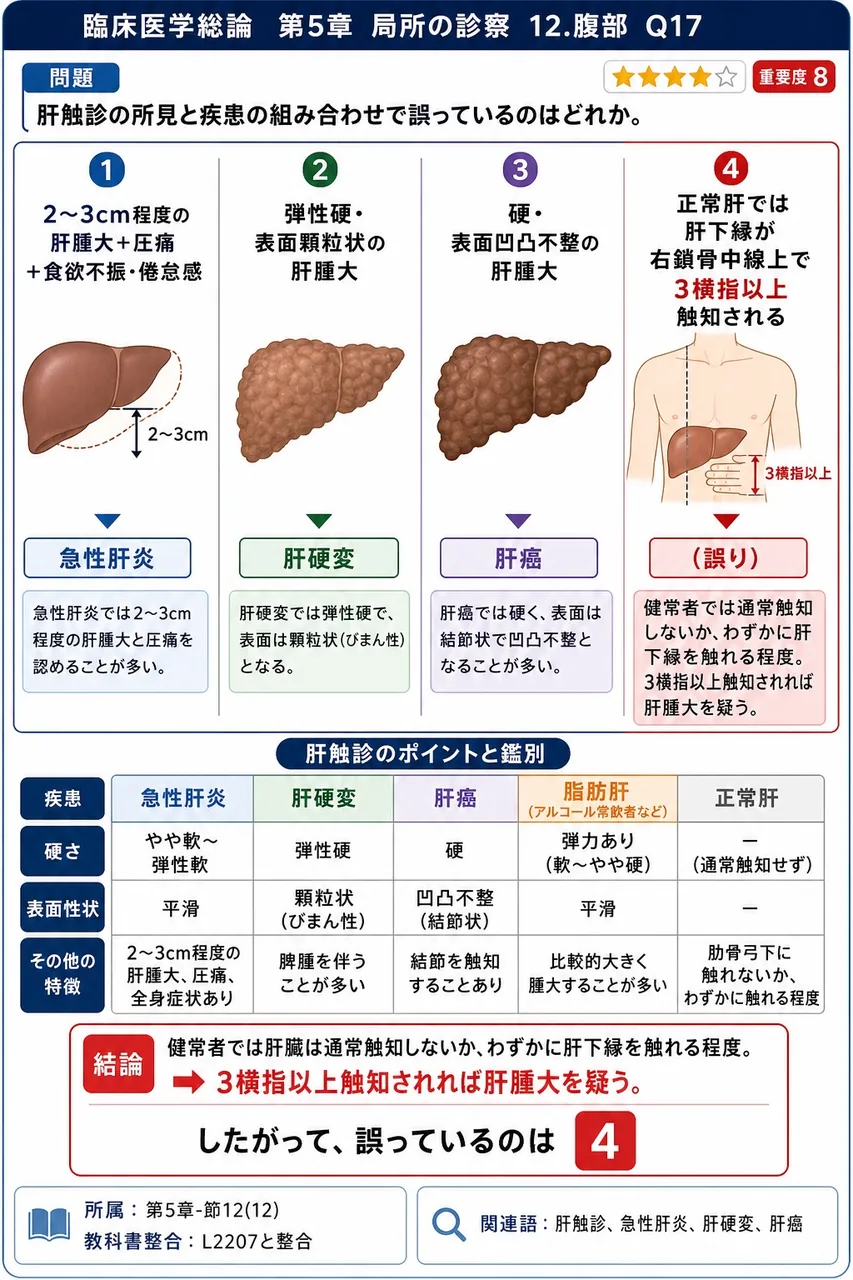 肝触診の所見と疾患の組み合わせで誤っているのはどれか。 解説図