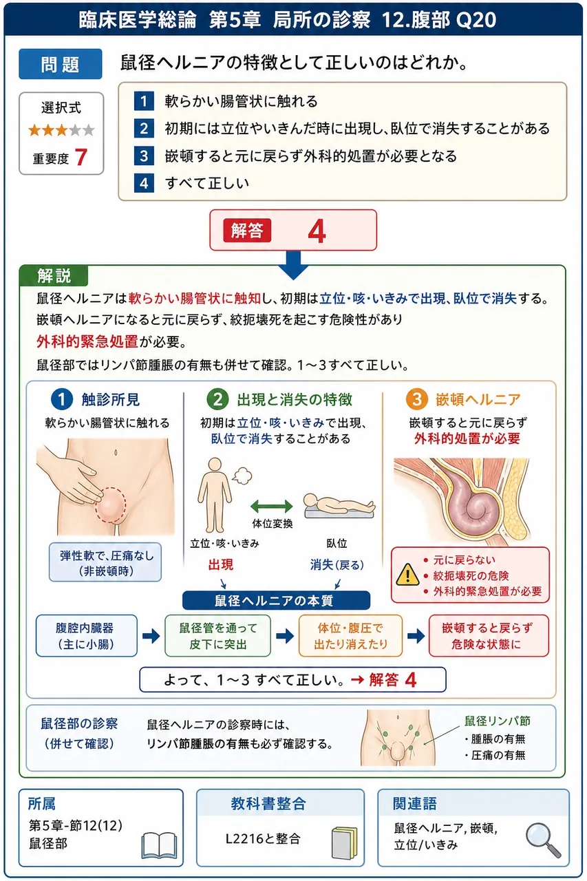 鼠径ヘルニアの特徴として正しいのはどれか。 解説図