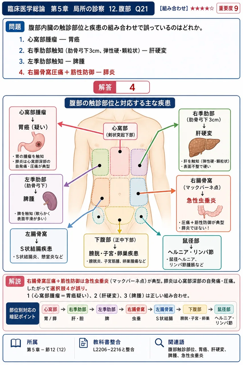 腹部内臓の触診部位と疾患の組み合わせで誤っているのはどれか。 解説図