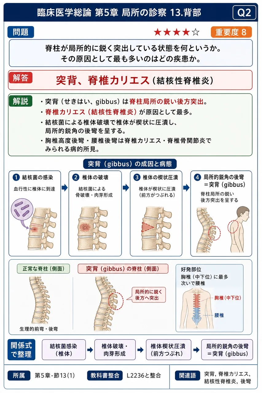 脊柱が局所的に鋭く突出している状態を何というか。その原因として最も多いのはどの疾患か。 解説図