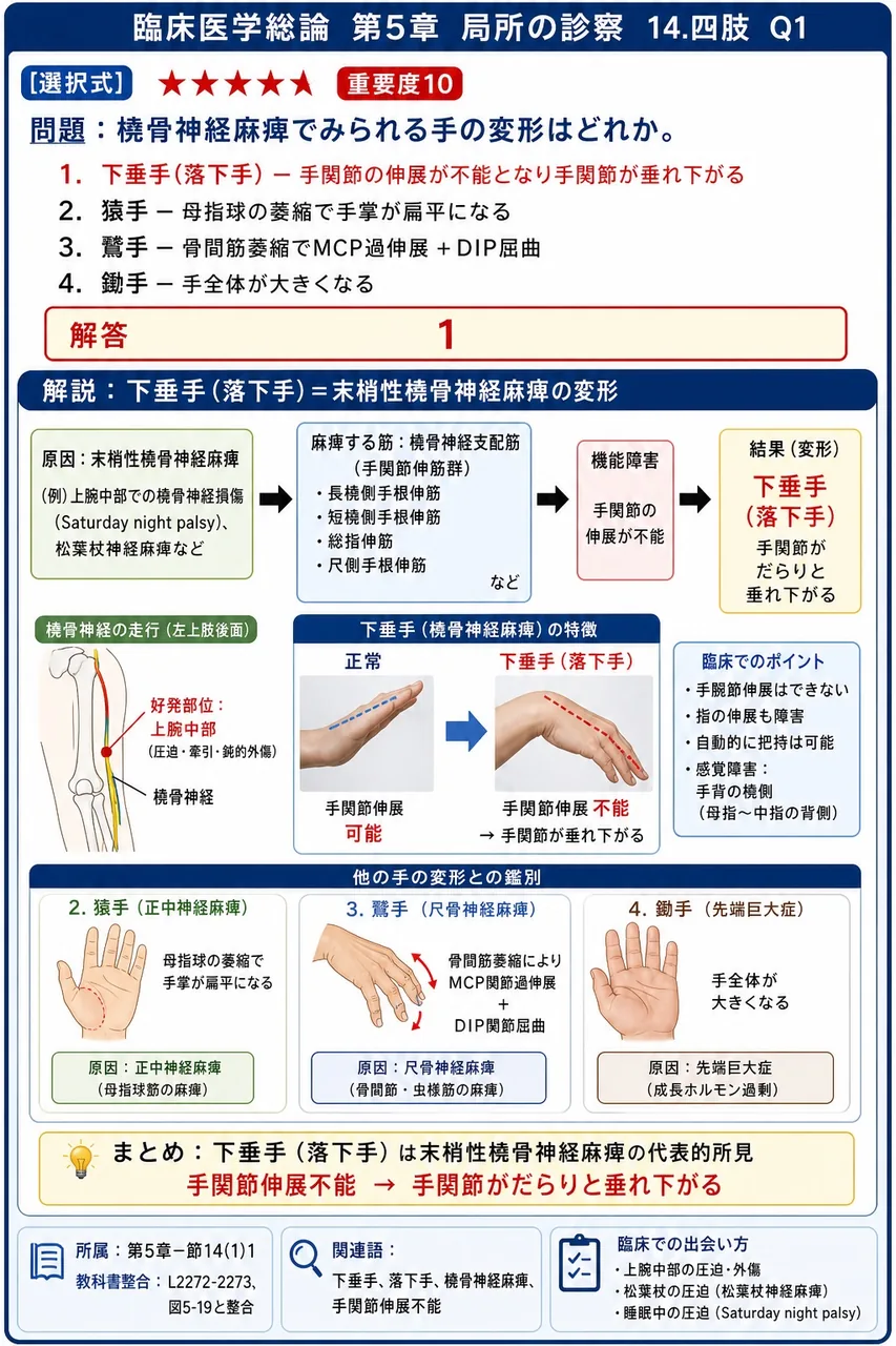 橈骨神経麻痺でみられる手の変形はどれか。 解説図