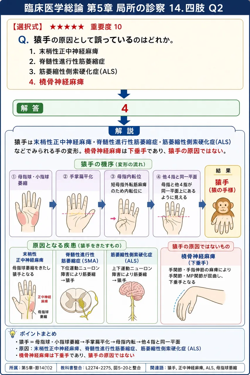 猿手の原因として誤っているのはどれか。 解説図
