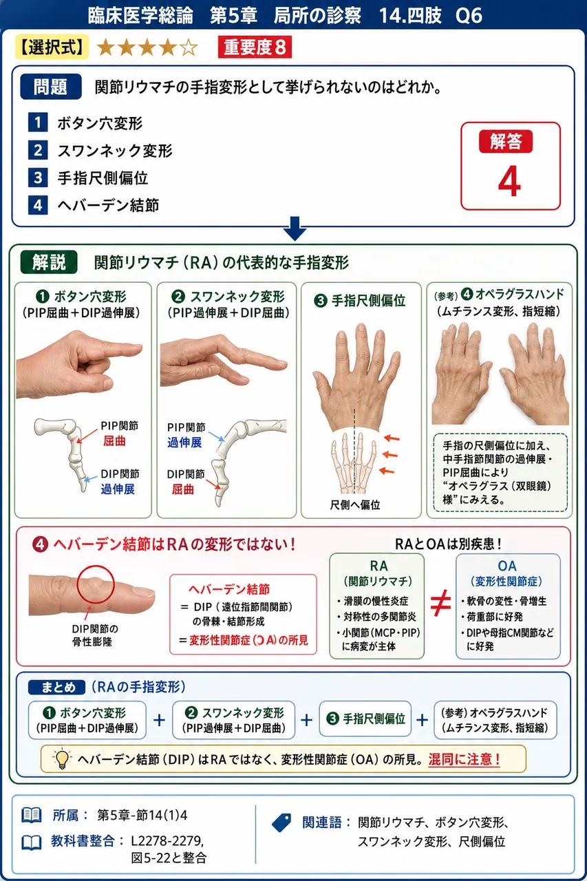 関節リウマチの手指変形として挙げられないのはどれか。 解説図
