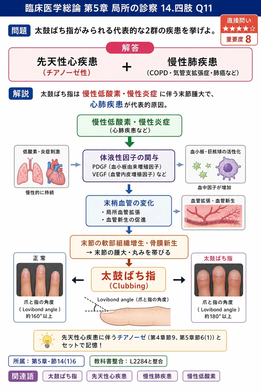 太鼓ばち指がみられる代表的な2群の疾患を挙げよ。 解説図
