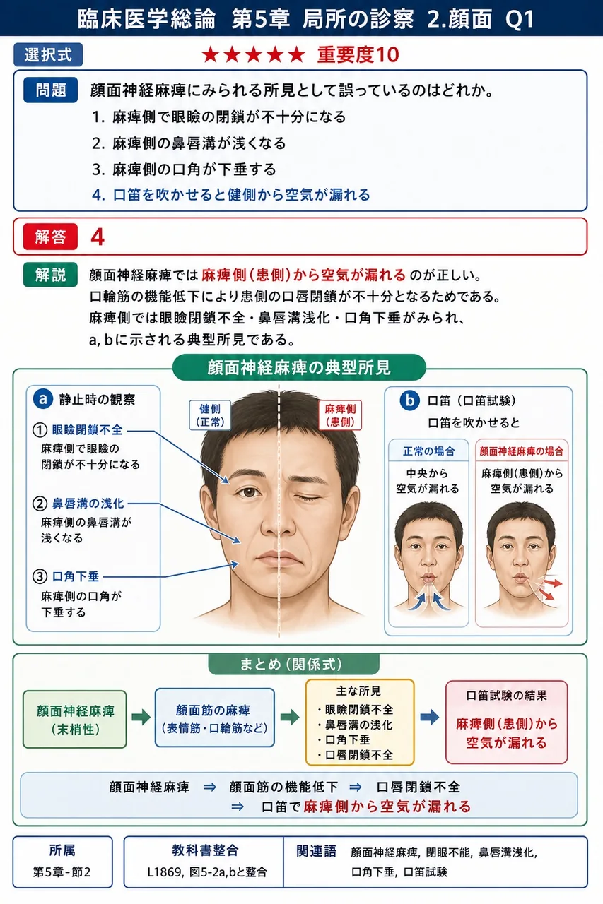 顔面神経麻痺にみられる所見として誤っているのはどれか。 解説図