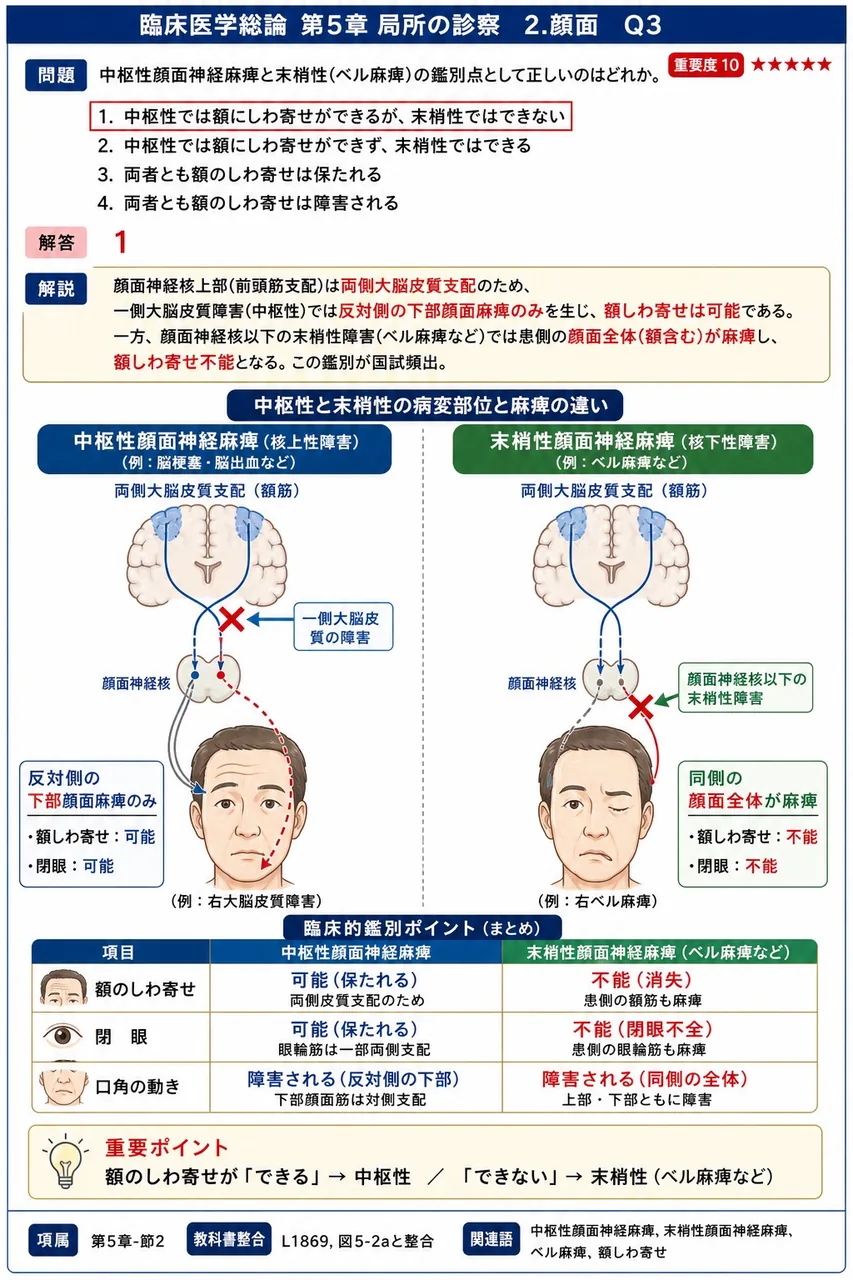 中枢性顔面神経麻痺と末梢性(ベル麻痺)の鑑別点として正しいのはどれか。 解説図