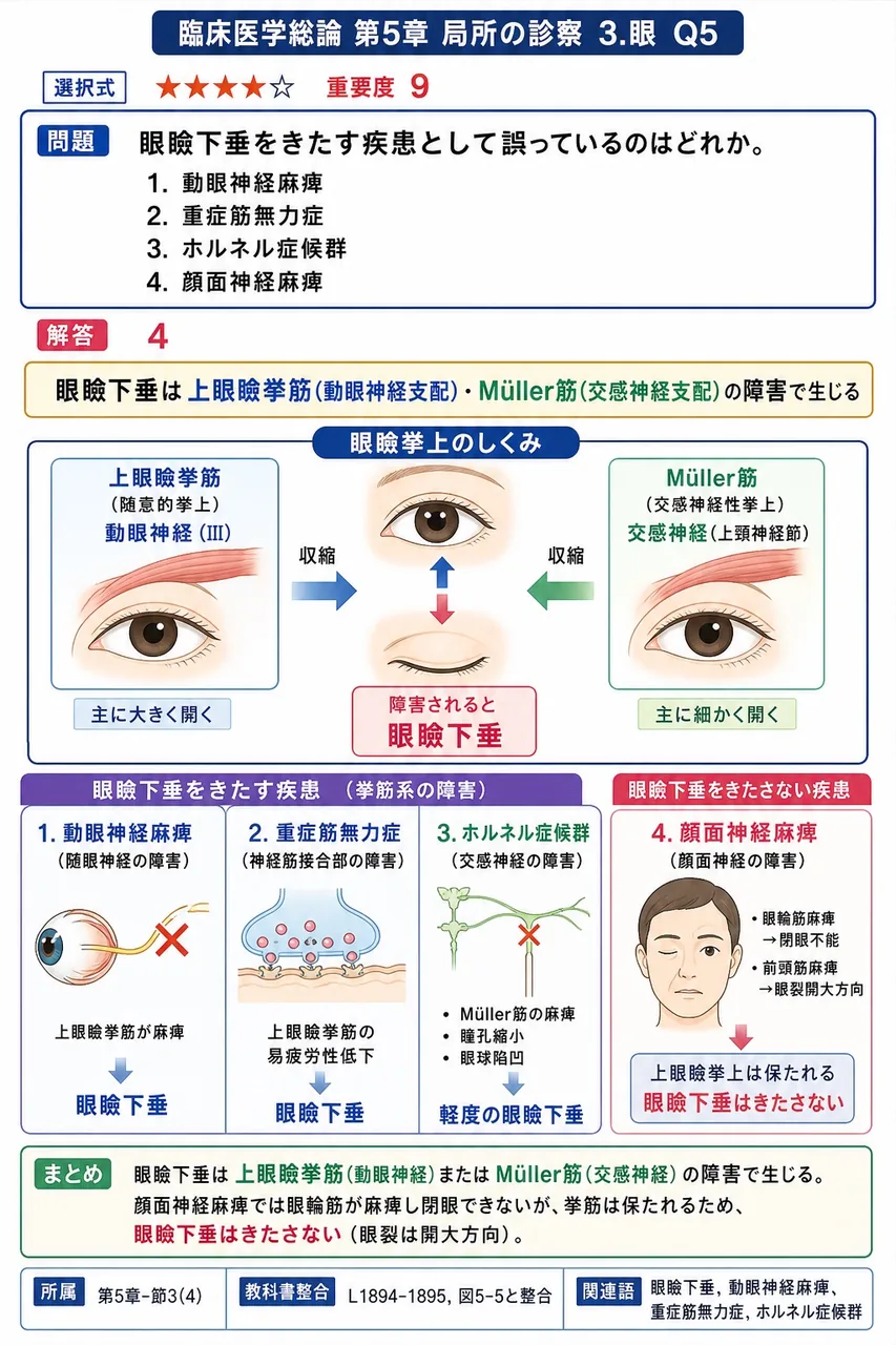 眼瞼下垂をきたす疾患として誤っているのはどれか。 解説図