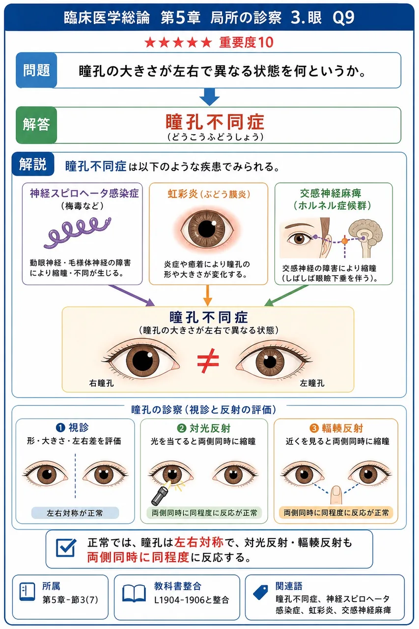 瞳孔の大きさが左右で異なる状態を何というか。 解説図