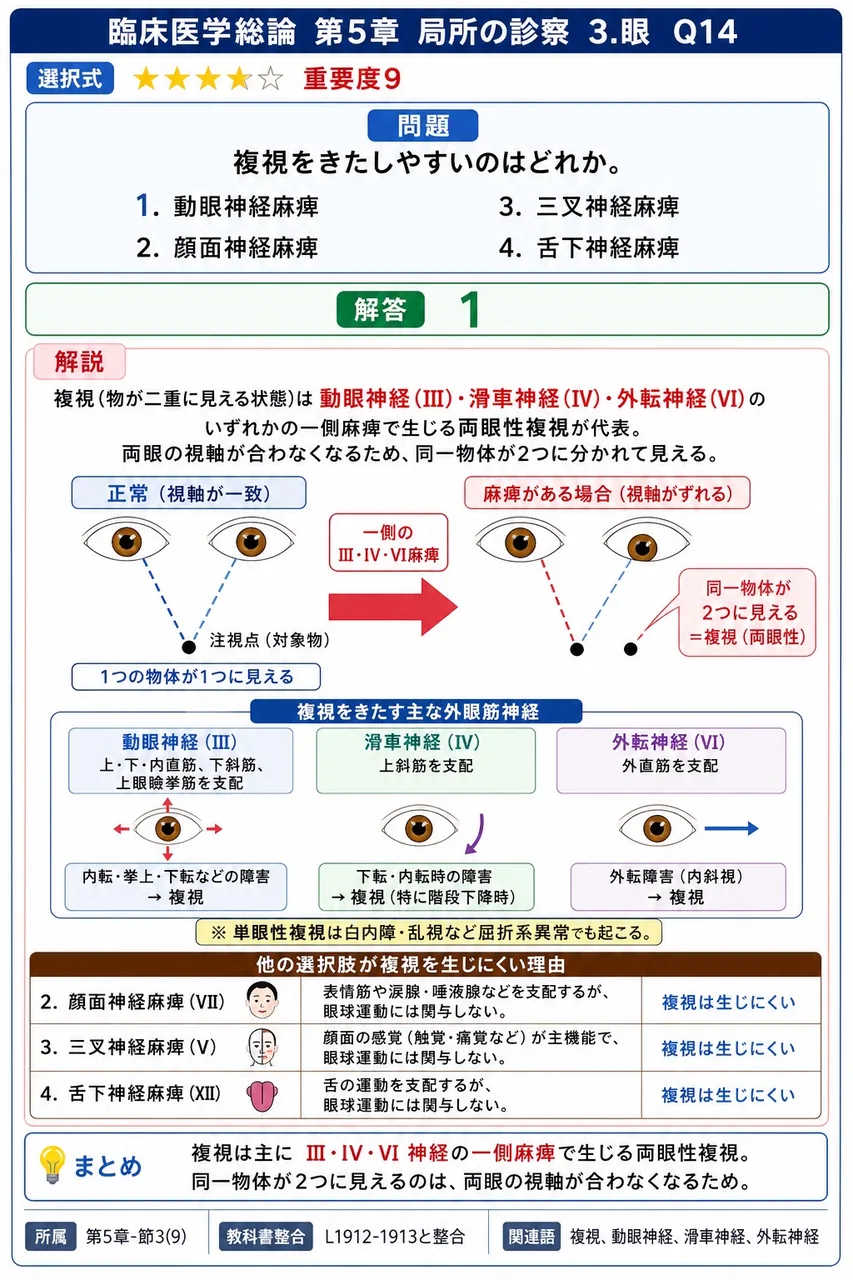 複視をきたしやすいのはどれか。 解説図