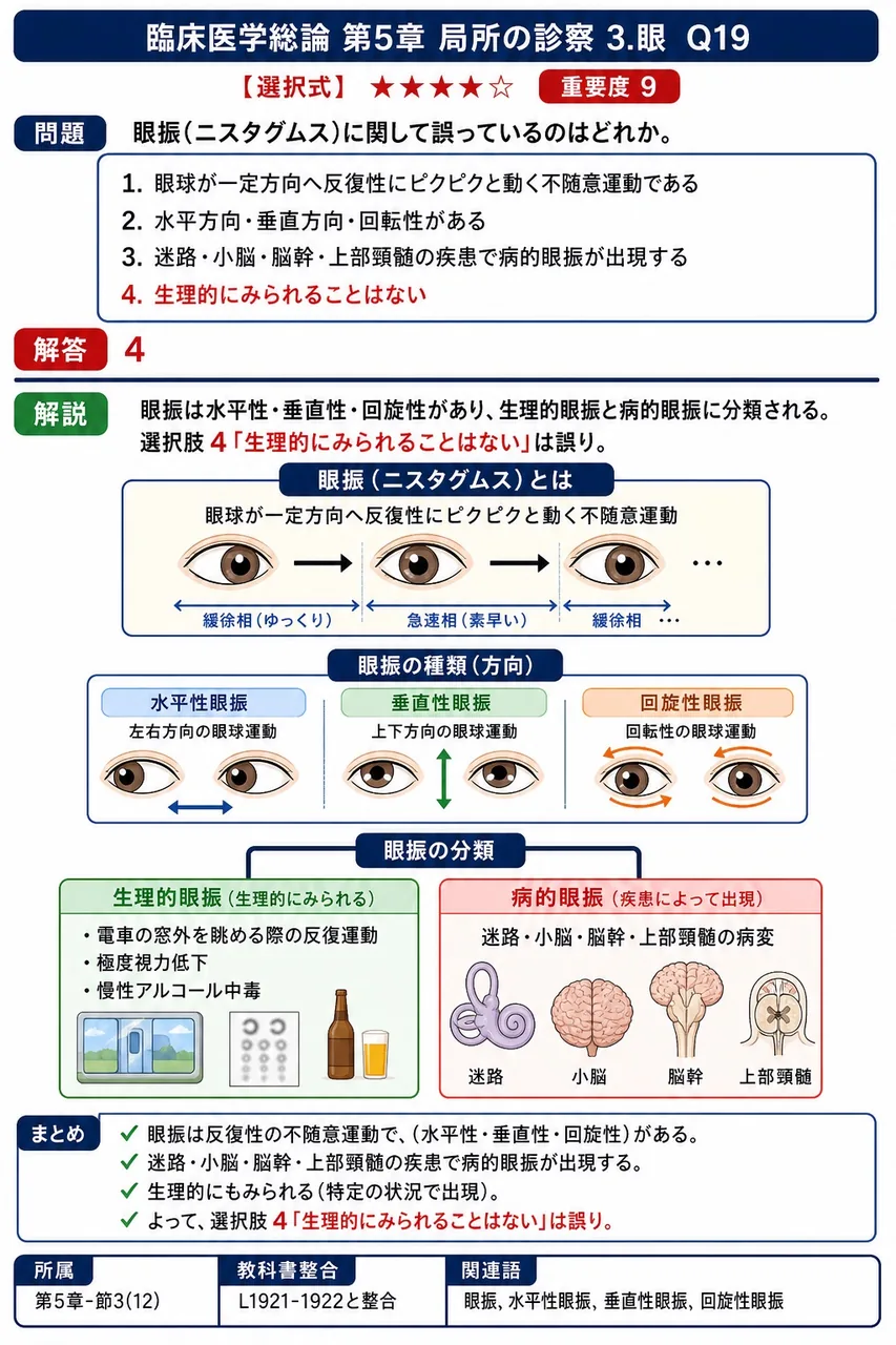 眼振(ニスタグムス)に関して誤っているのはどれか。 解説図