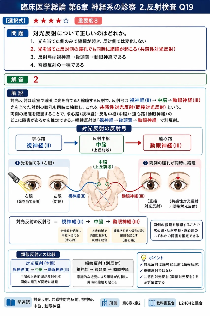 対光反射について正しいのはどれか。 解説図