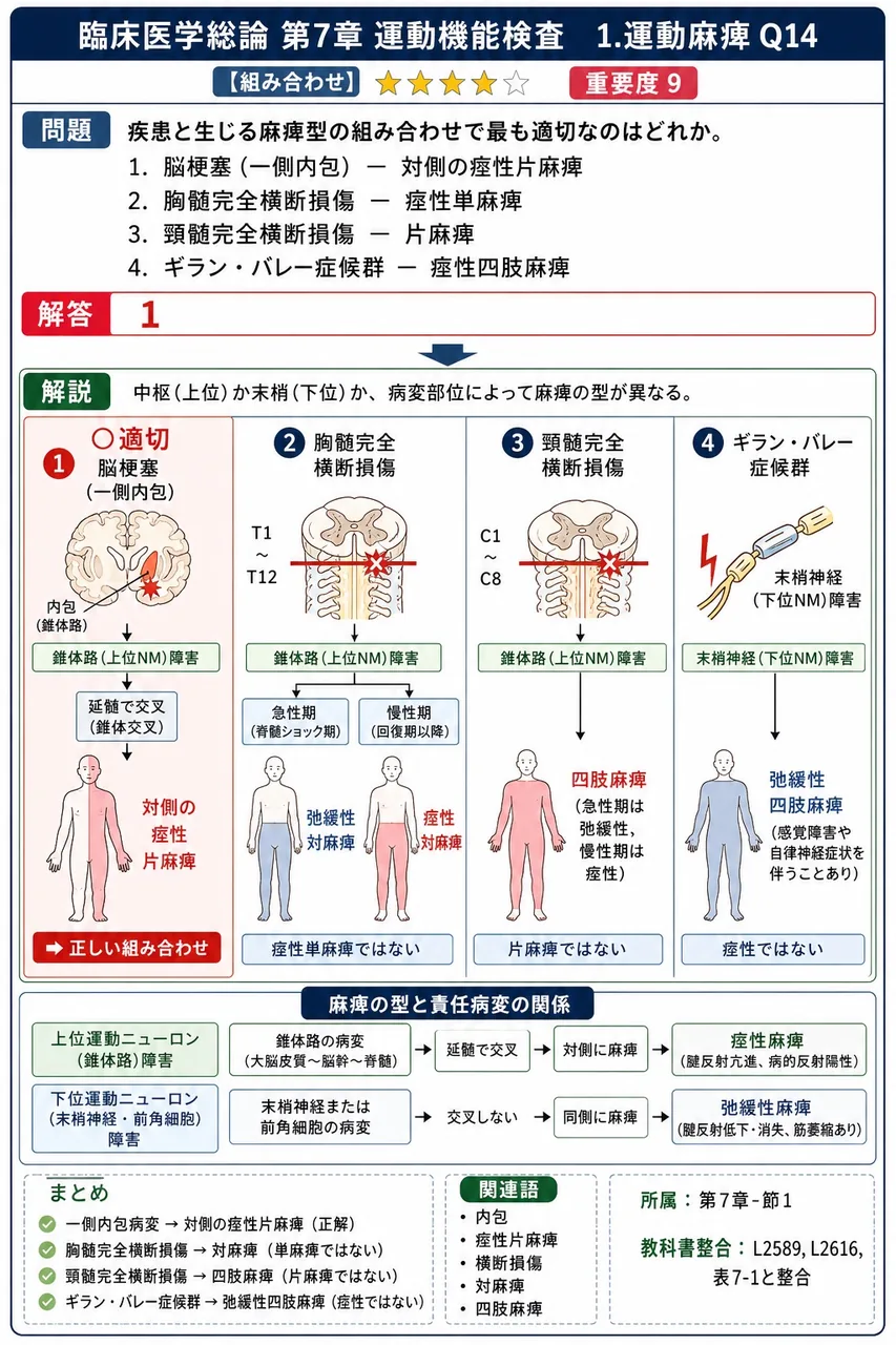 疾患と生じる麻痺型の組み合わせで最も適切なのはどれか。 解説図