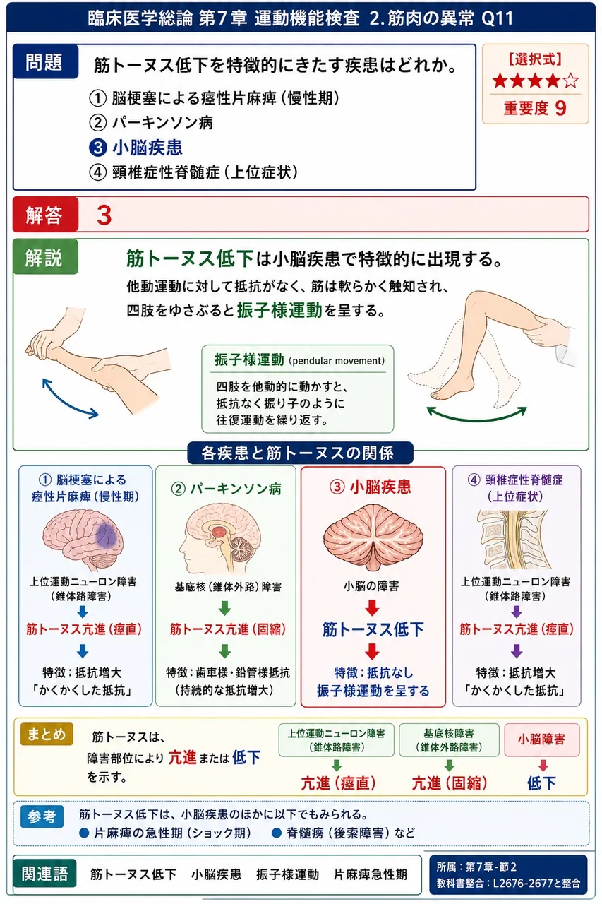 筋トーヌス低下を特徴的にきたす疾患はどれか。 解説図