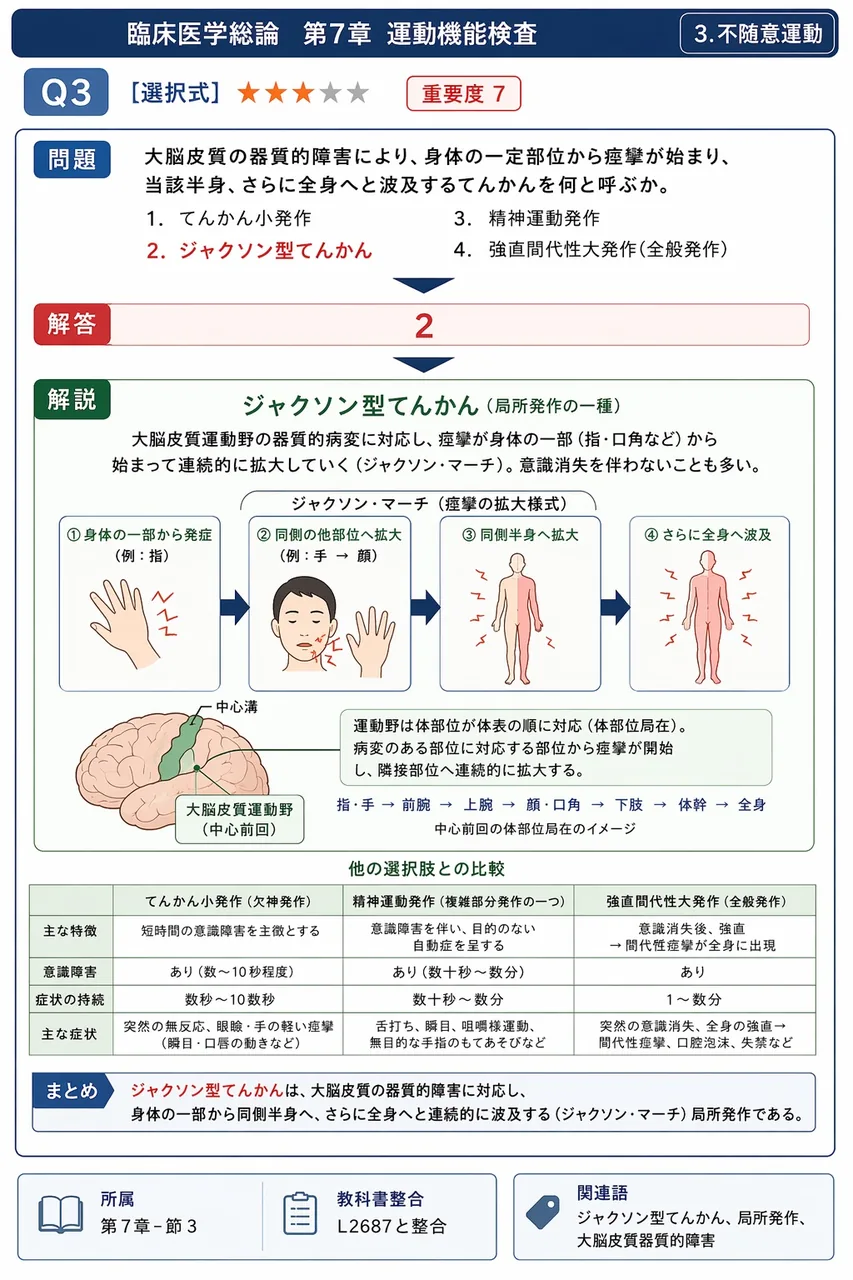 大脳皮質の器質的障害により、身体の一定部位から痙攣が始まり、当該半身、さらに全身へと波及するてんかんを何と呼ぶか。 解説図