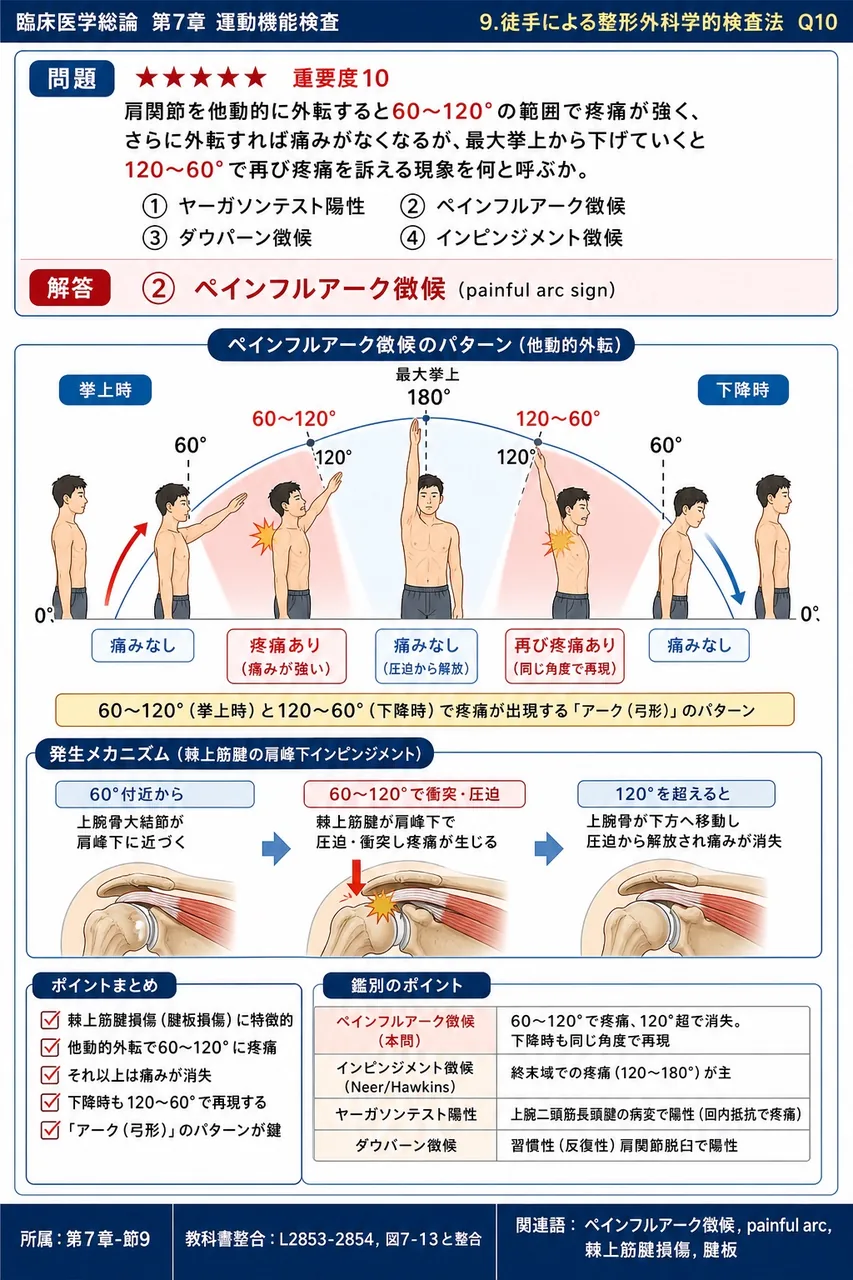 肩関節を他動的に外転すると60〜120°の範囲で疼痛が強く、さらに外転すれば痛みがなくなるが、最大挙上から下げていくと120〜60°で再び疼痛を訴える現象を何と呼ぶか。 解説図
