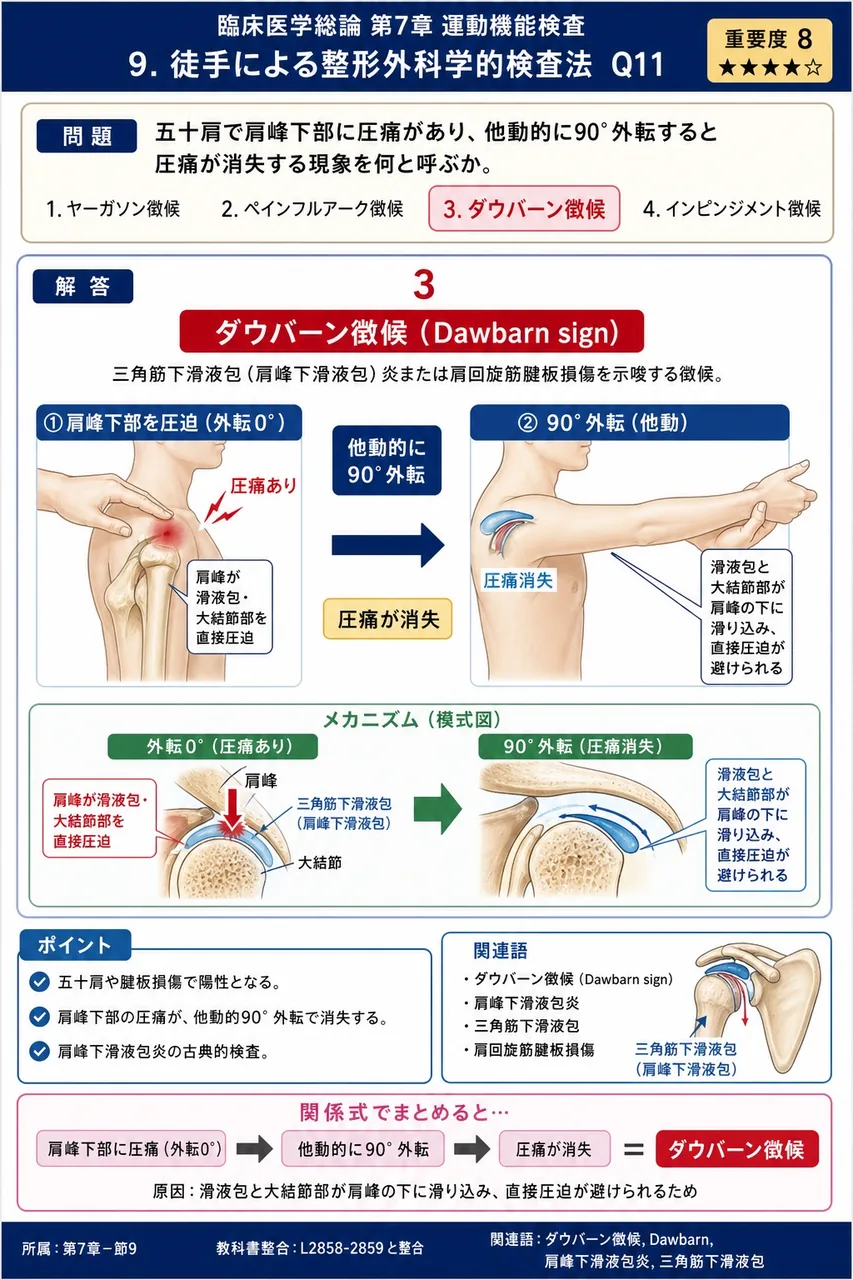 五十肩で肩峰下部に圧痛があり、他動的に90°外転すると圧痛が消失する現象を何と呼ぶか。 解説図