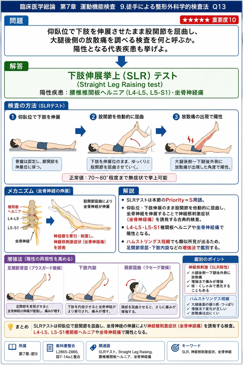 仰臥位で下肢を伸展させたまま股関節を屈曲し、大腿後側の放散痛を調べる検査を何と呼ぶか。陽性となる代表疾患も挙げよ。 解説図
