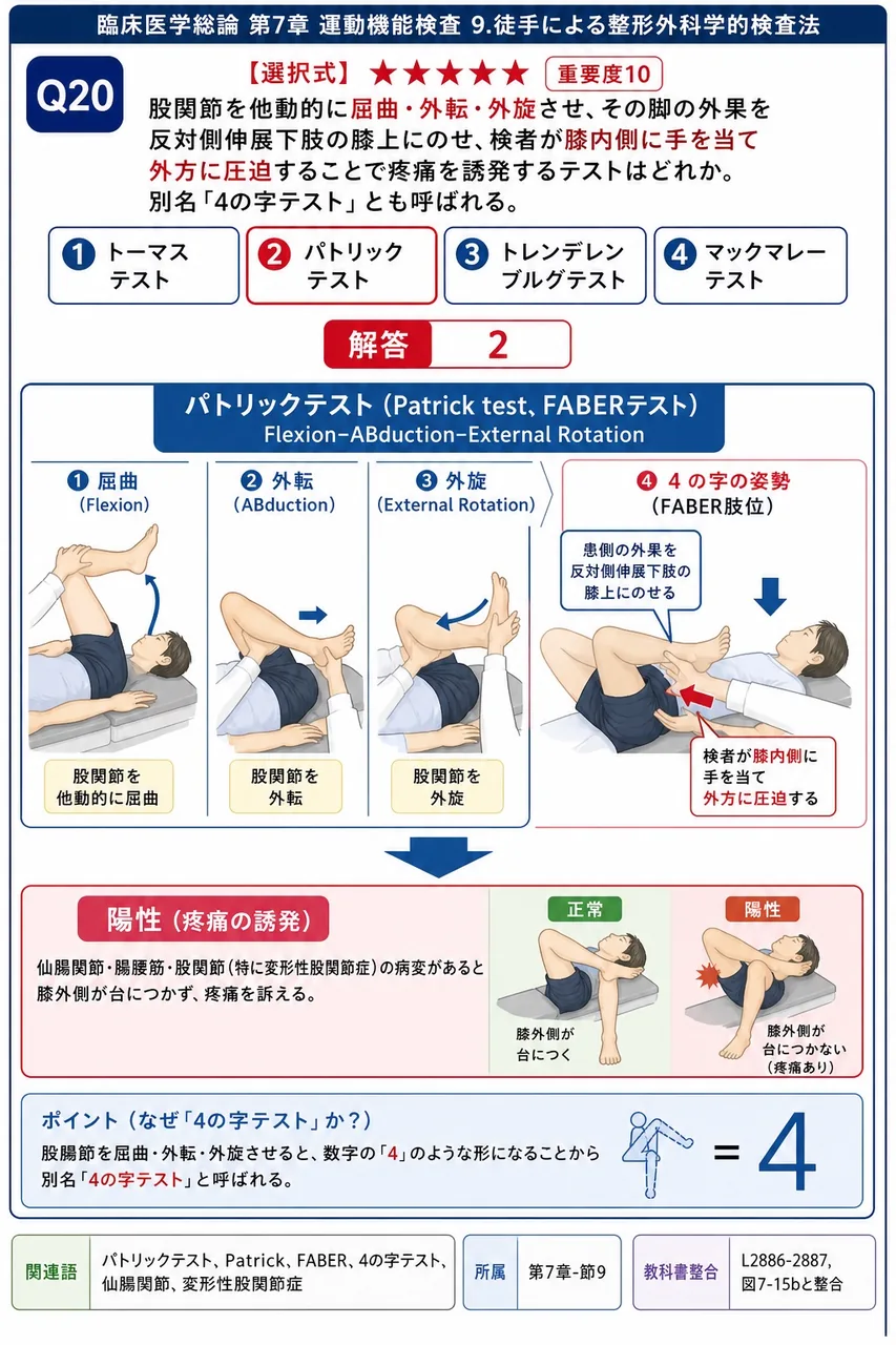 股関節を他動的に屈曲・外転・外旋させ、その脚の外果を反対側伸展下肢の膝上にのせ、検者が膝内側に手を当て外方に圧迫することで疼痛を誘発するテストはどれか。別名「4の字テスト」とも呼ばれる。 解説図