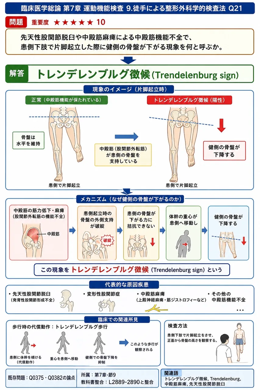 先天性股関節脱臼や中殿筋麻痺による中殿筋機能不全で、患側下肢で片脚起立した際に健側の骨盤が下がる現象を何と呼ぶか。 解説図