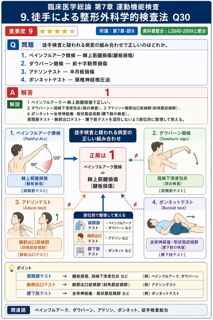 徒手検査と疑われる病変の組み合わせで正しいのはどれか。 解説図