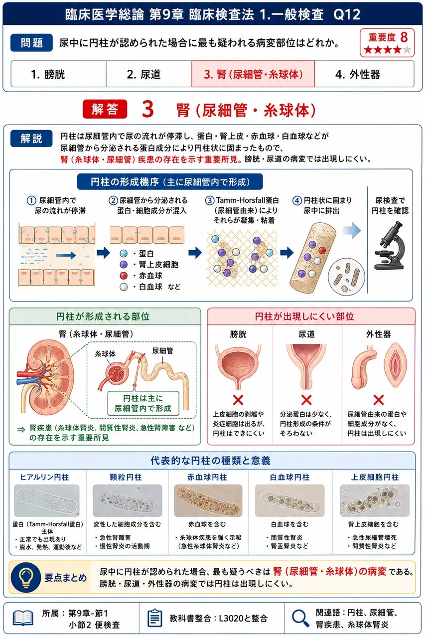 尿中に円柱が認められた場合に最も疑われる病変部位はどれか。 解説図
