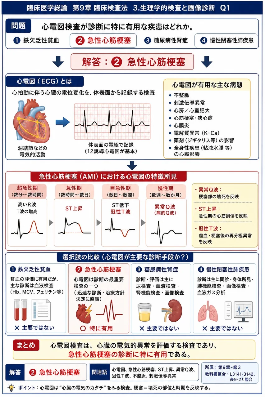 心電図検査が診断に特に有用な疾患はどれか。 解説図