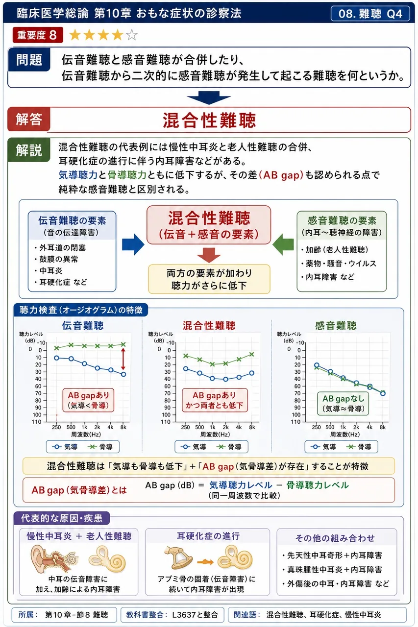 伝音難聴と感音難聴が合併したり、伝音難聴から二次的に感音難聴が発生して起こる難聴を何というか。 解説図