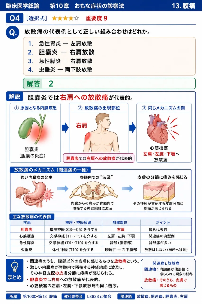 放散痛の代表例として正しい組み合わせはどれか。 解説図